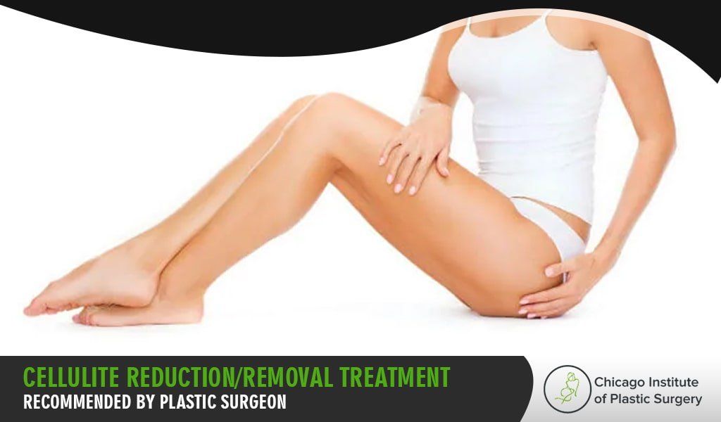 plastic surgery to remove cellulite